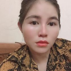 Nâng mũi 1 năm trên sóng mũi hơi đỏ nổi mạch máu li ti, làm sao để hết?