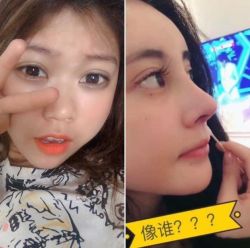 Mũi em liệu có nâng được lên như thần tượng này không?