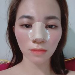 Miếng nẹp mũi muốn rớt ra do mồ hôi có sao không ạ?