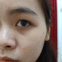 Xin tư vấn cho da dầu mụn, lỗ chân lông to