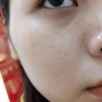 Xin tư vấn cho da dầu mụn, lỗ chân lông to