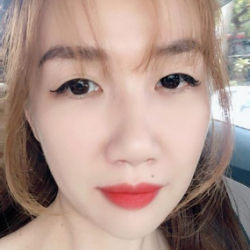Sửa mí sau 1 năm cắt mí: kết quả bị nhiều nếp mí, lộ đường mí