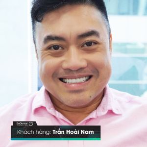 Hình ảnh bọc răng sứ - Nha khoa BeDental – Ca 12