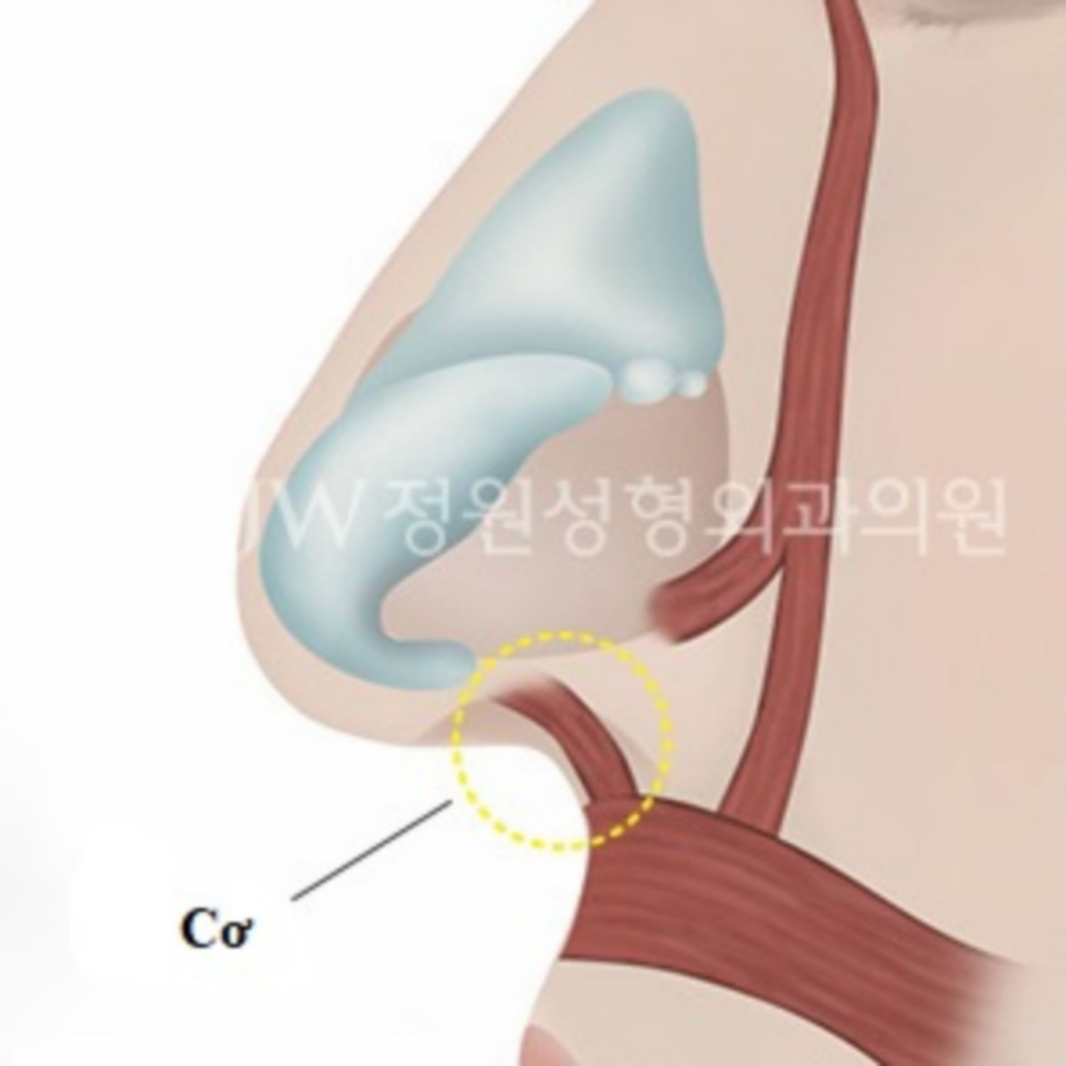 cắt cơ