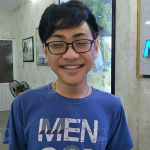 Hình ảnh niềng răng của KH Hoàng Tùng Lâm – Ca 13