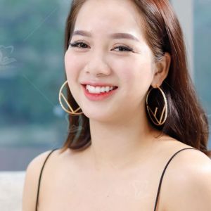 Hình ảnh bọc răng sứ của một nữ KH xinh đẹp – Ca 14