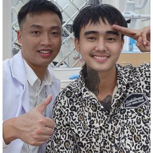 Hình ảnh niềng răng của KH Đạt G – Ca 8