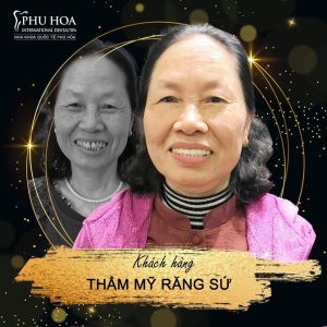 Hình ảnh bọc răng sứ Nha khoa Quốc tế Phú Hòa - Ca 10