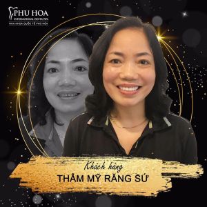 Hình ảnh bọc răng sứ Nha khoa Quốc tế Phú Hòa - Ca 4