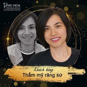 Hình ảnh bọc răng sứ Nha khoa Quốc tế Phú Hòa - Ca 7