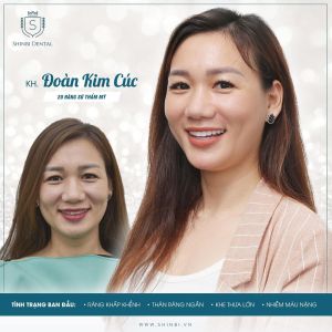 Hình ảnh bọc răng sứ của KH Đoàn Thị Kim Cúc – Viện CN Nha khoa Thẩm mỹ Shinbi – Ca 3