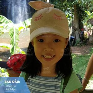 Hình ảnh niềng răng mắc cài của KH Lưu Khánh Chi – Nha khoa Smile one – Ca 11