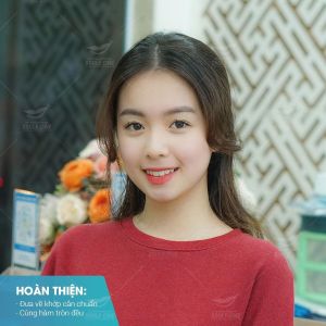Hình ảnh niềng răng mắc cài của Trần Khánh Chi – Nha khoa Smile one – Ca 3