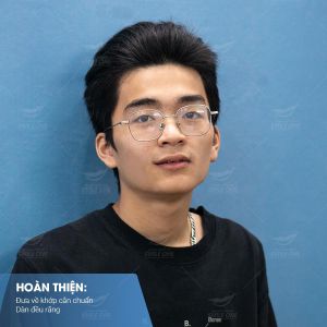 Hình ảnh niềng răng mắc cài của KH Anh Tú – Nha khoa Smile one – Ca 6