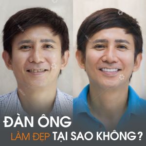 Hình ảnh bọc răng sứ - Viện NKQT Smile up  - Ca 14