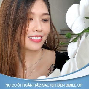 Hình ảnh bọc răng sứ của KH Thắm Bùi – Viện NKQT Smile up – Ca 15