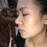 Mũi nguyên bản muốn sửa thấp đầu mũi