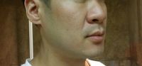 Thu gọn cánh mũi có đủ để chỉnh sửa mũi to, mũi củ hành ở nam giới không? Thu gọn cánh mũi có đủ để chỉnh sửa mũi to, mũi củ hành ở nam giới không?