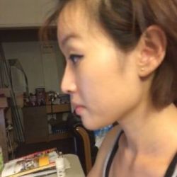 Chỉnh sửa mũi gồ