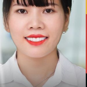 Hình ảnh bọc răng sứ của KH Linh Nhi – Nha khoa TMQT Delia – Ca 11