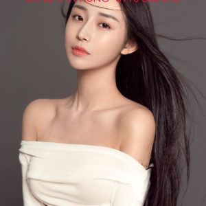 Hình ảnh phẫu thuật hàm và hạ gò má của KH Li Chiao Yin – Viện Thẩm mỹ Hùng Vương – Ca 4