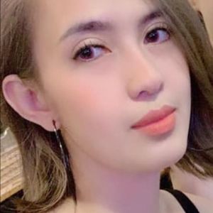 Hình ảnh phẫu thuật hàm của KH Kim Ngân – Viện Thẩm mỹ Hùng Vương – Ca 5