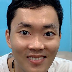 Hình ảnh phẫu thuật hàm của KH Nguyễn Văn Hải – Viện Thẩm mỹ Hùng Vương – Ca 6