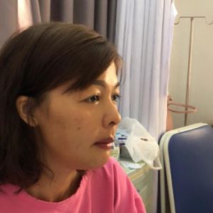 Hình ảnh phẫu thuật hàm của KH Nguyễn Thị Hạnh – Viện Thẩm mỹ Hùng Vương – Ca 7