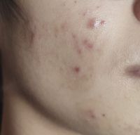 Dùng bha có bị sao?