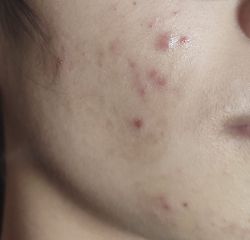 Dùng bha có bị sao?