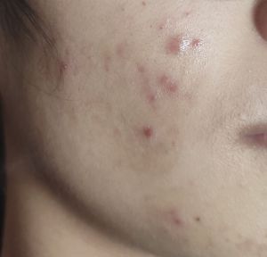 Dùng bha có bị sao?