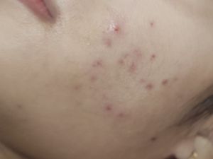 Dùng bha có bị sao?