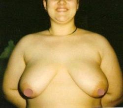 Cách khắc phục 2 vú sa trễ và cách xa nhau