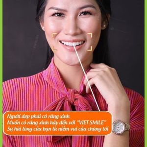 Hình ảnh dán sứ Veneer – Nha khoa Viet Smile – Ca 11