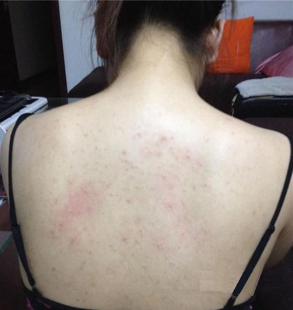 Hết mụn lưng, hotgirl Thùy Trang khoe body gợi cảm khiến mọi người ngỡ ngàng