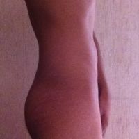 Vũ công nam, di chuyển và thực hiện nhiều tư thế, liệu có thể đặt túi độn mông, có nguy cơ lộ túi không?