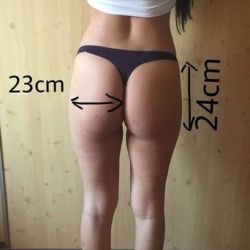 Size túi độn mông nào phù hợp với tôi?