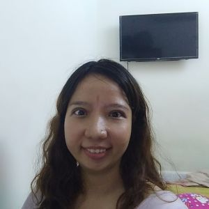 Mắt em cắt được 2 tháng đã hết sưng nề nhưng vẫn bị co rút nên trợn