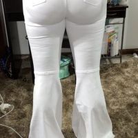 2 năm sau BBL: mông bên to bên nhỏ