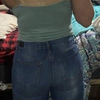 2 năm sau BBL: mông bên to bên nhỏ