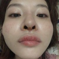 Mũi không đều cánh