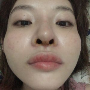 Mũi không đều cánh