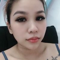 Cắt mí