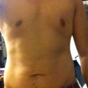 Tôi có phù hợp làm tạo hình thành bụng mini?