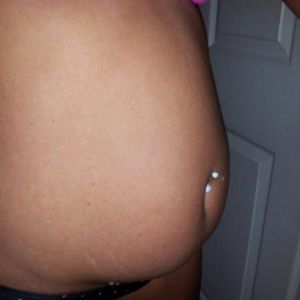 Tôi 33 tuổi, nặng 61kg, cao 1m61. Tôi có phù hợp làm tạo hình thành bụng mini không?