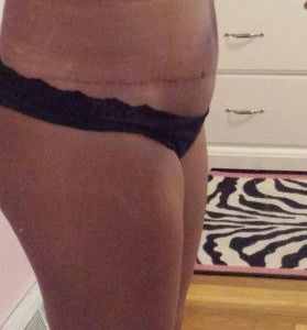 Tập luyện khiến sưng nề kéo dài hơn?