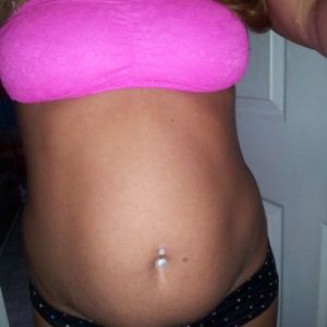 Tôi 33 tuổi, nặng 61kg, cao 1m61. Tôi có phù hợp làm tạo hình thành bụng mini không?