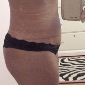 Tập luyện khiến sưng nề kéo dài hơn?