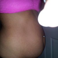 Tôi 33 tuổi, nặng 61kg, cao 1m61. Tôi có phù hợp làm tạo hình thành bụng mini không?