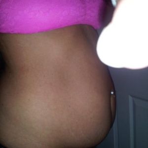 Tôi 33 tuổi, nặng 61kg, cao 1m61. Tôi có phù hợp làm tạo hình thành bụng mini không?